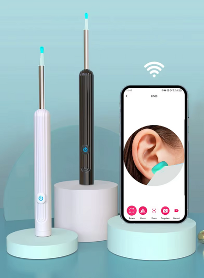Nettoyeur d’Oreilles Visuel Sans Fil 1296P HD | Otoscope WiFi avec Caméra & 6 LED