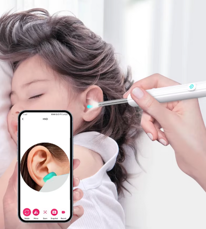 Nettoyeur d’Oreilles Visuel Sans Fil 1296P HD | Otoscope WiFi avec Caméra & 6 LED