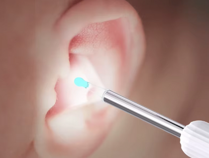 Nettoyeur d’Oreilles Visuel Sans Fil 1296P HD | Otoscope WiFi avec Caméra & 6 LED